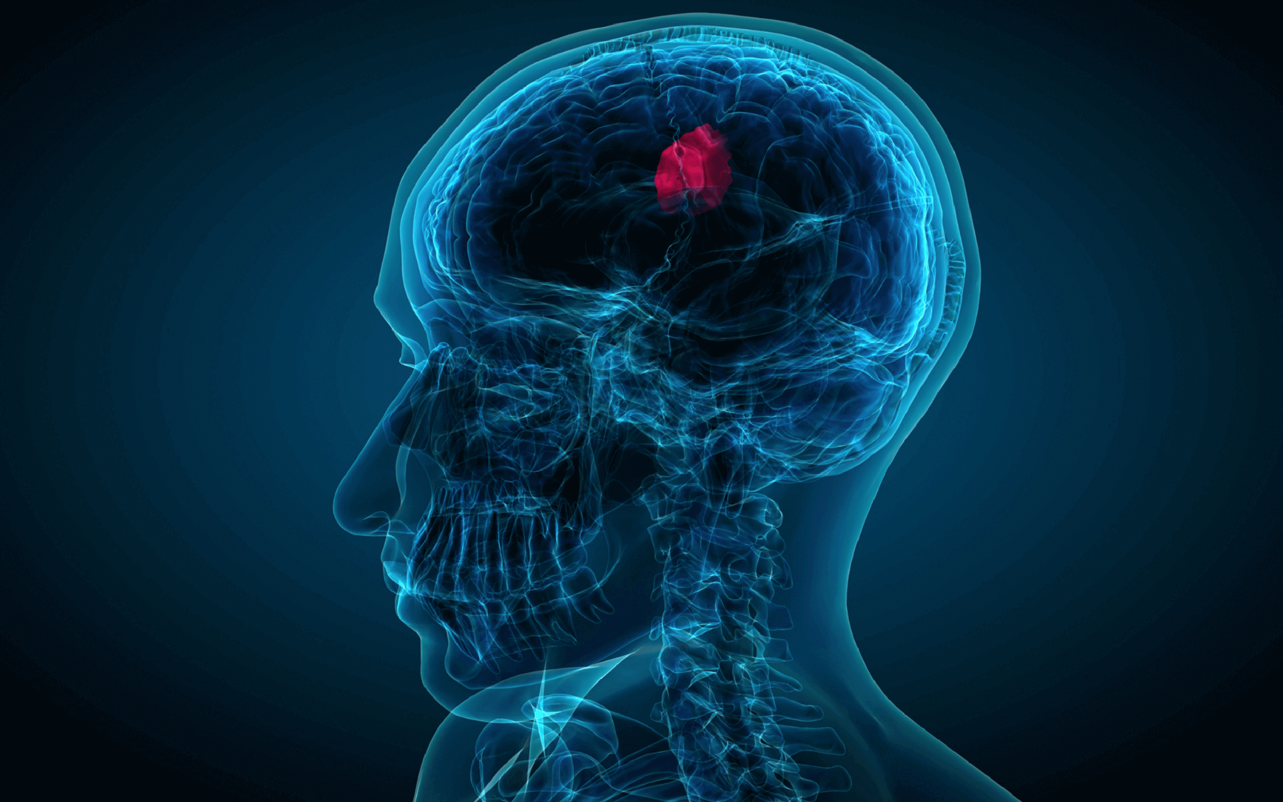 Brainwise Media